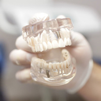 Временная коронка (зуб) из РММА, изготовленная методом CAD/CAM
